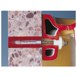 FIXATION DE LAVABO ET WC SUSPENDUS WDE